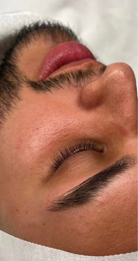Before facial treatment